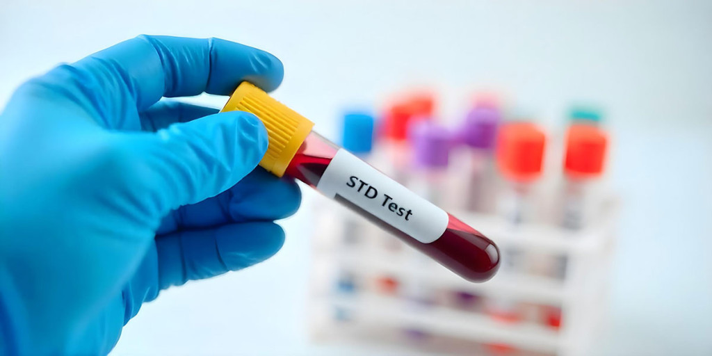 STD Testing